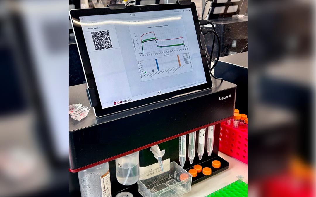 Attomarker To Lead New Medical Intervention to Explore Monoclonal Antibody Treatment for Long COVID