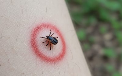 The Scale of Lyme Disease and Long Lyme: A Global Burden in Numbers